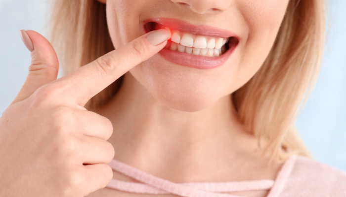 Why You Should Treasure Your Teeth’s Enamel