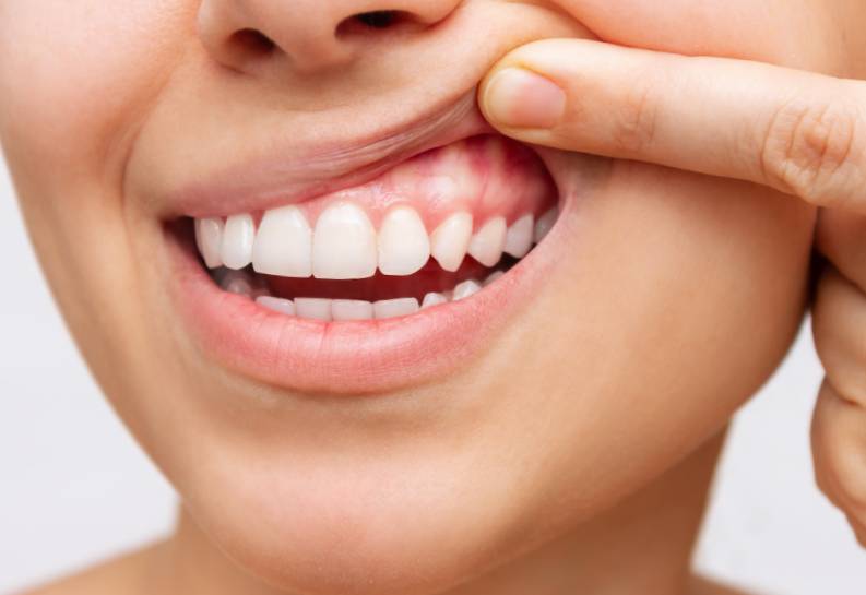 How Common are Dental Issues?