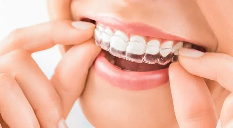 Is Invisalign Right for You?