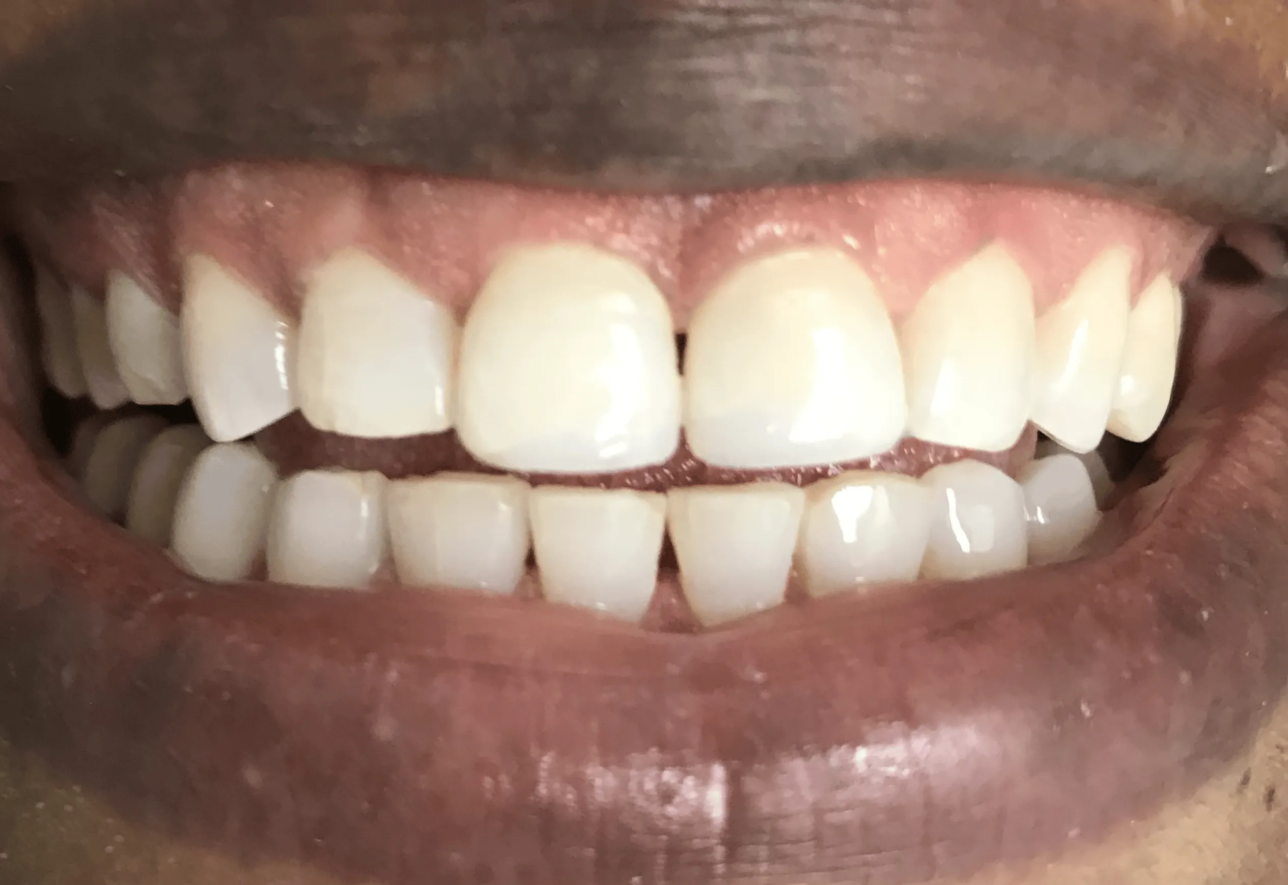 Pampered Smiles Dentistry