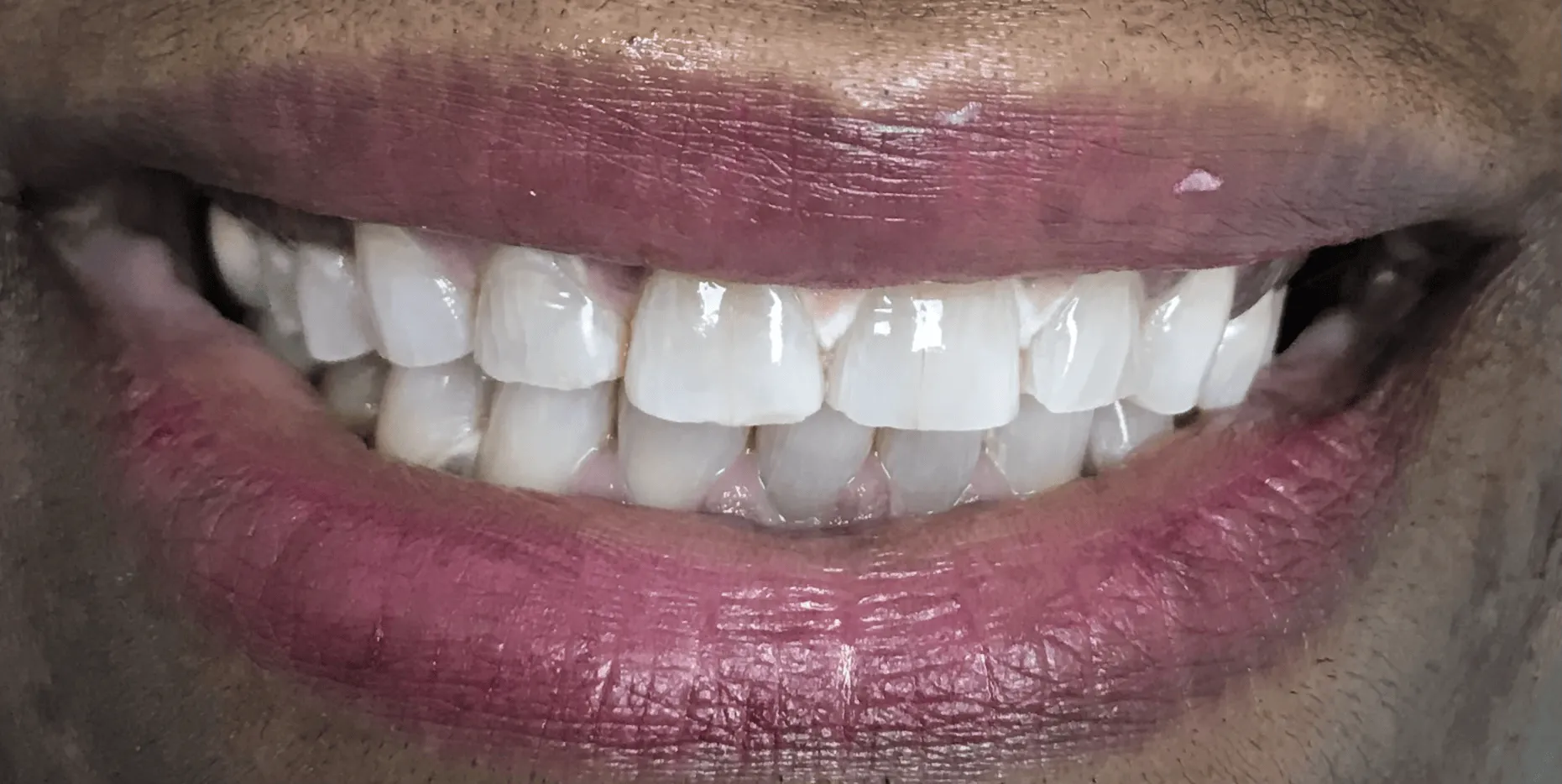 Pampered Smiles Dentistry