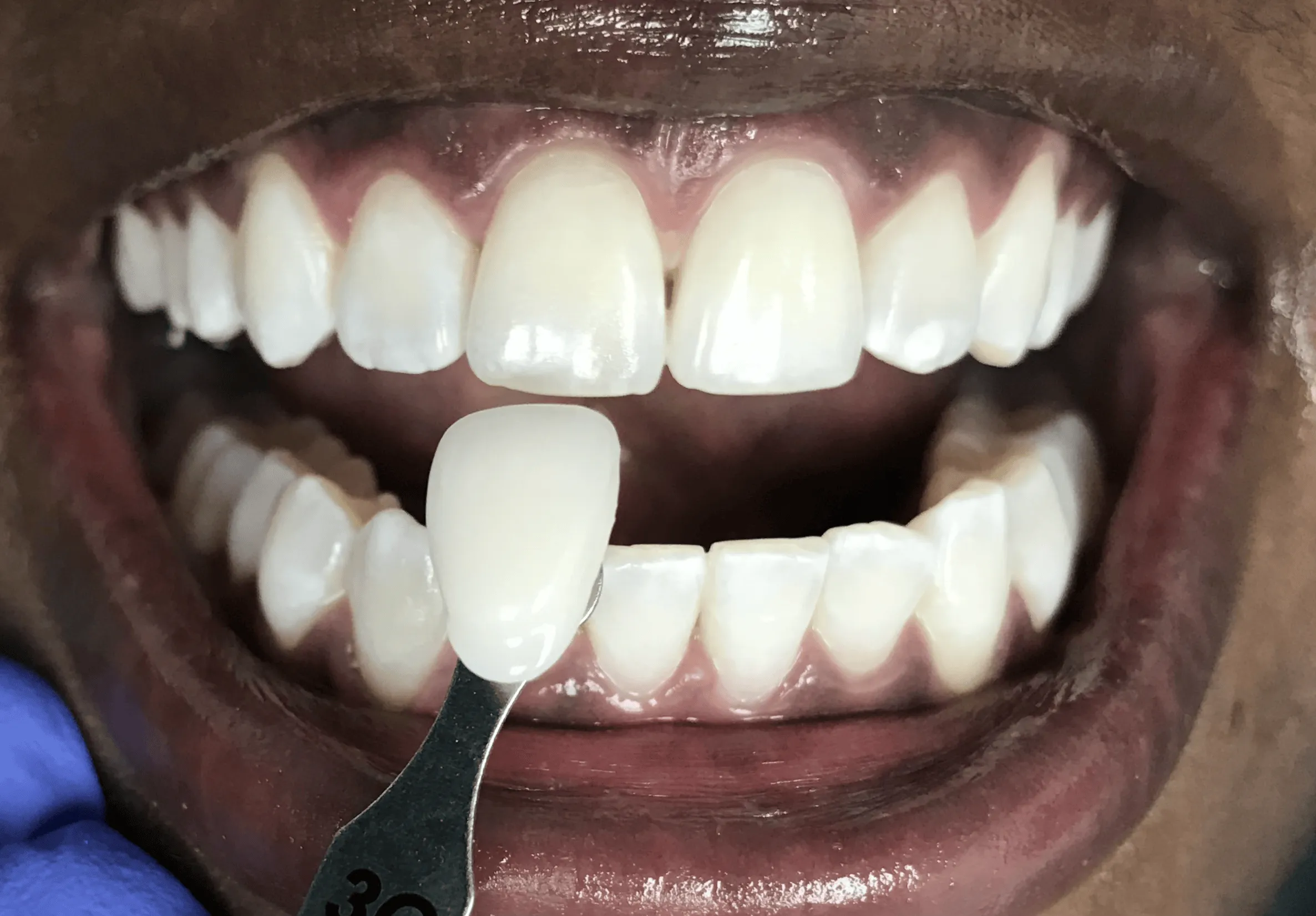 Pampered Smiles Dentistry