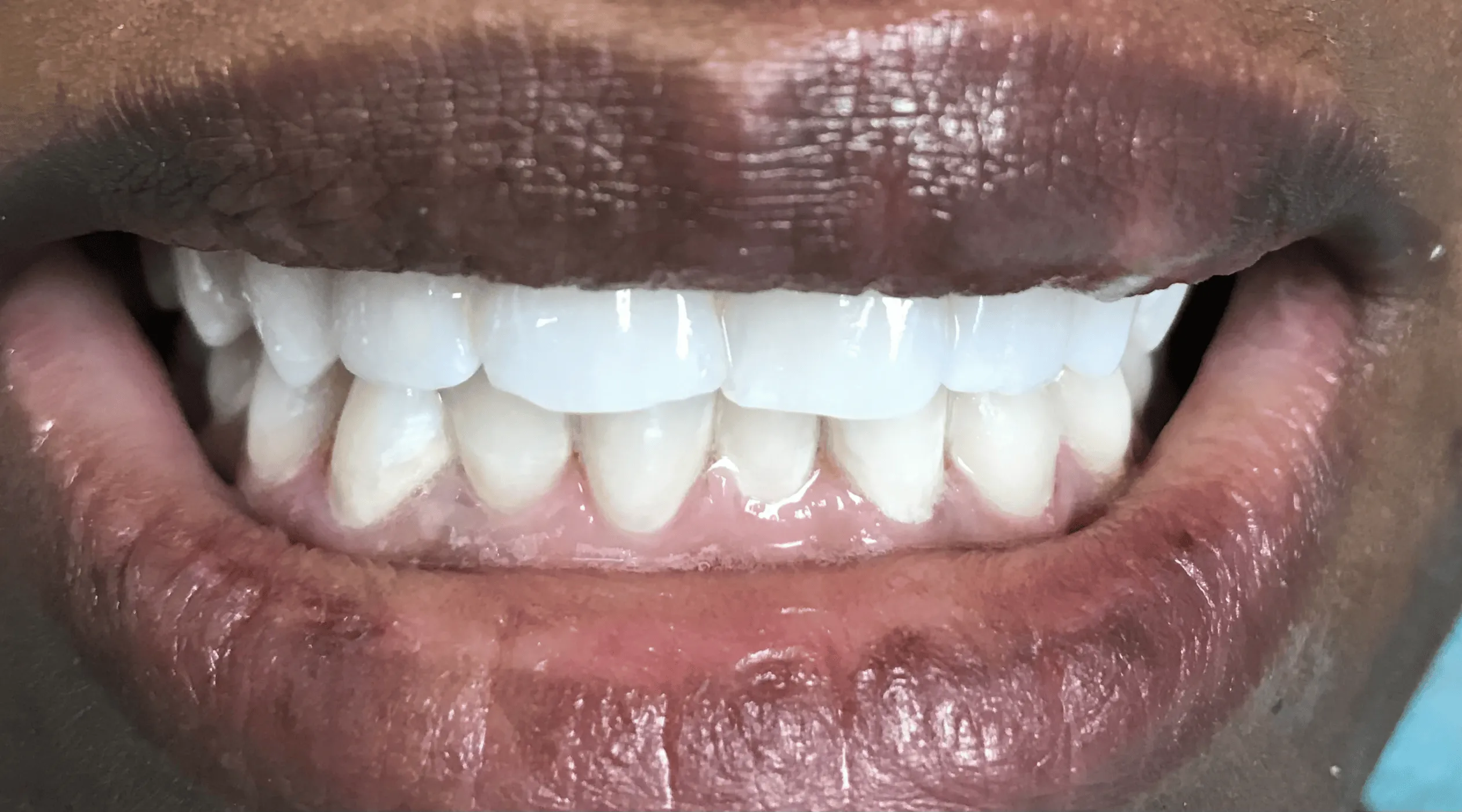 Pampered Smiles Dentistry