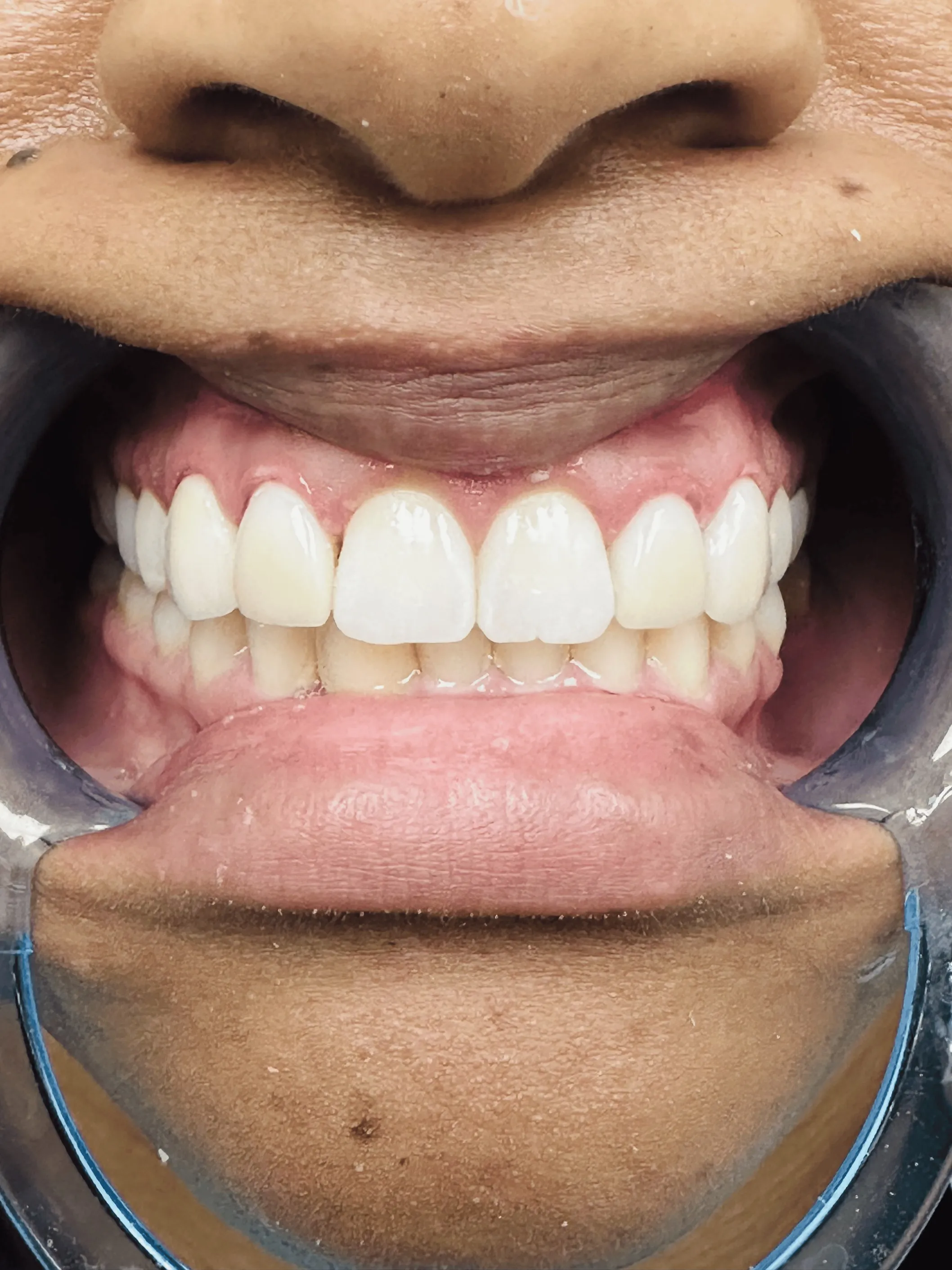 Pampered Smiles Dentistry