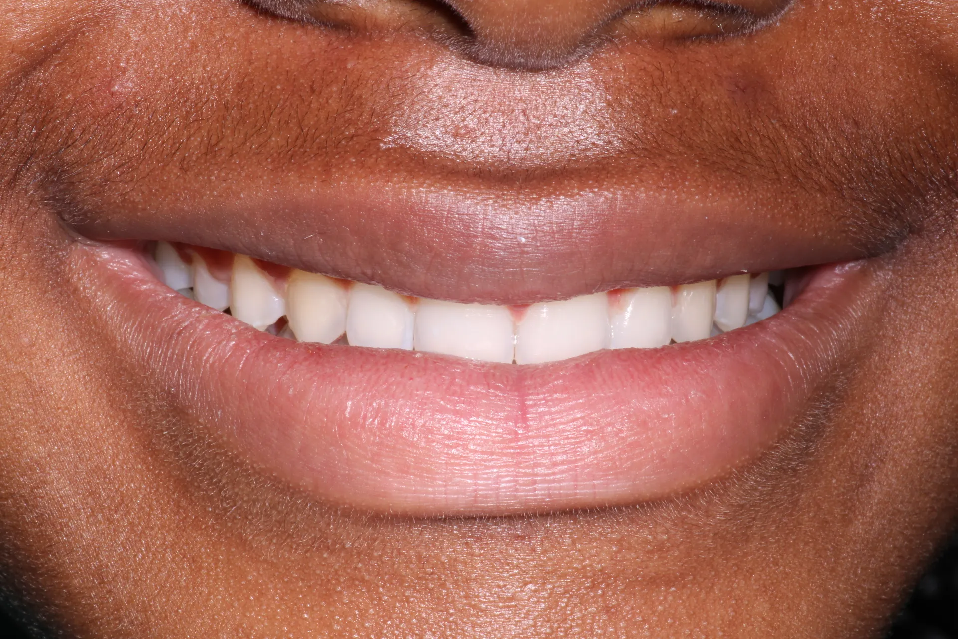 Pampered Smiles Dentistry