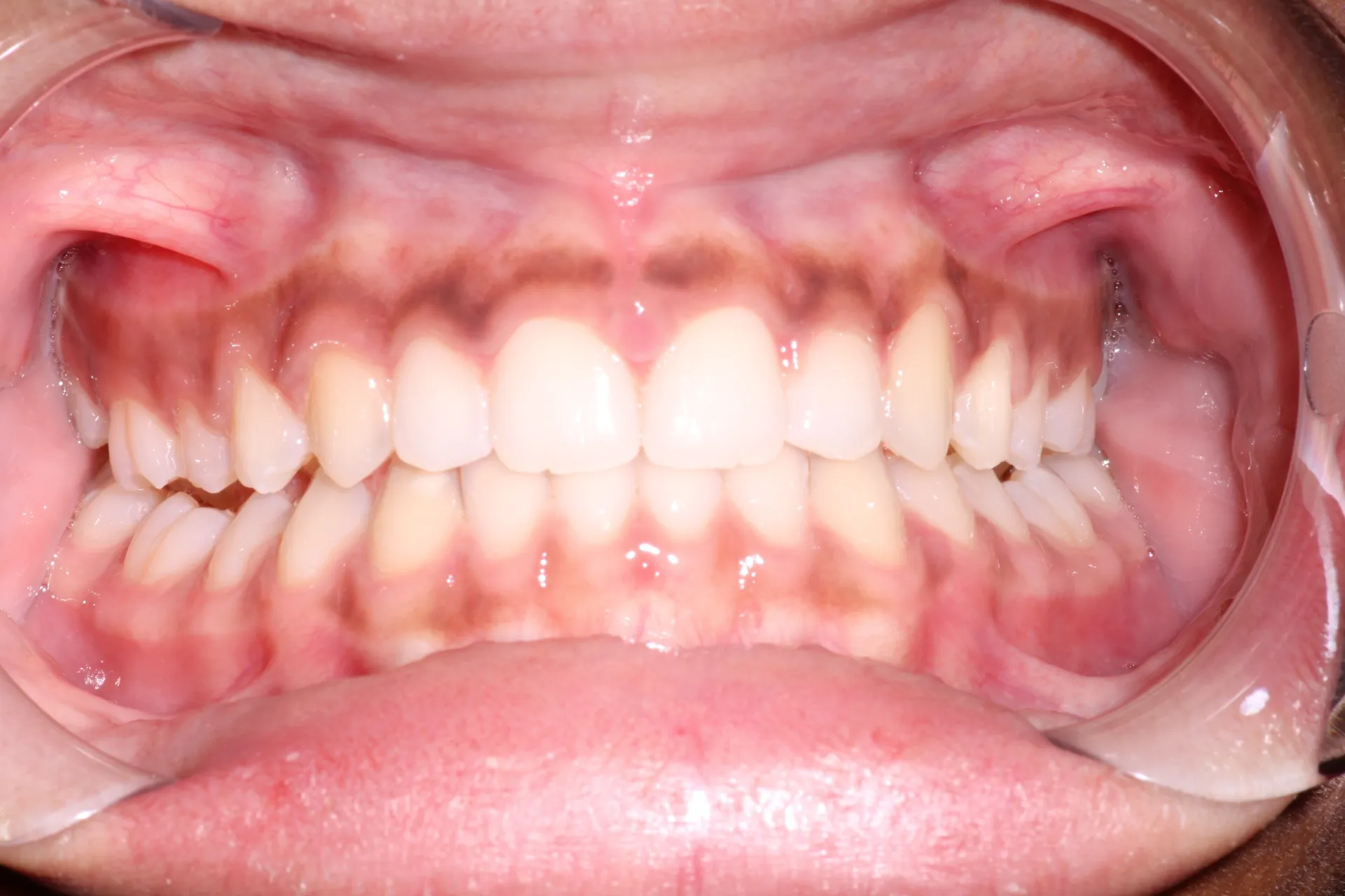 Pampered Smiles Dentistry