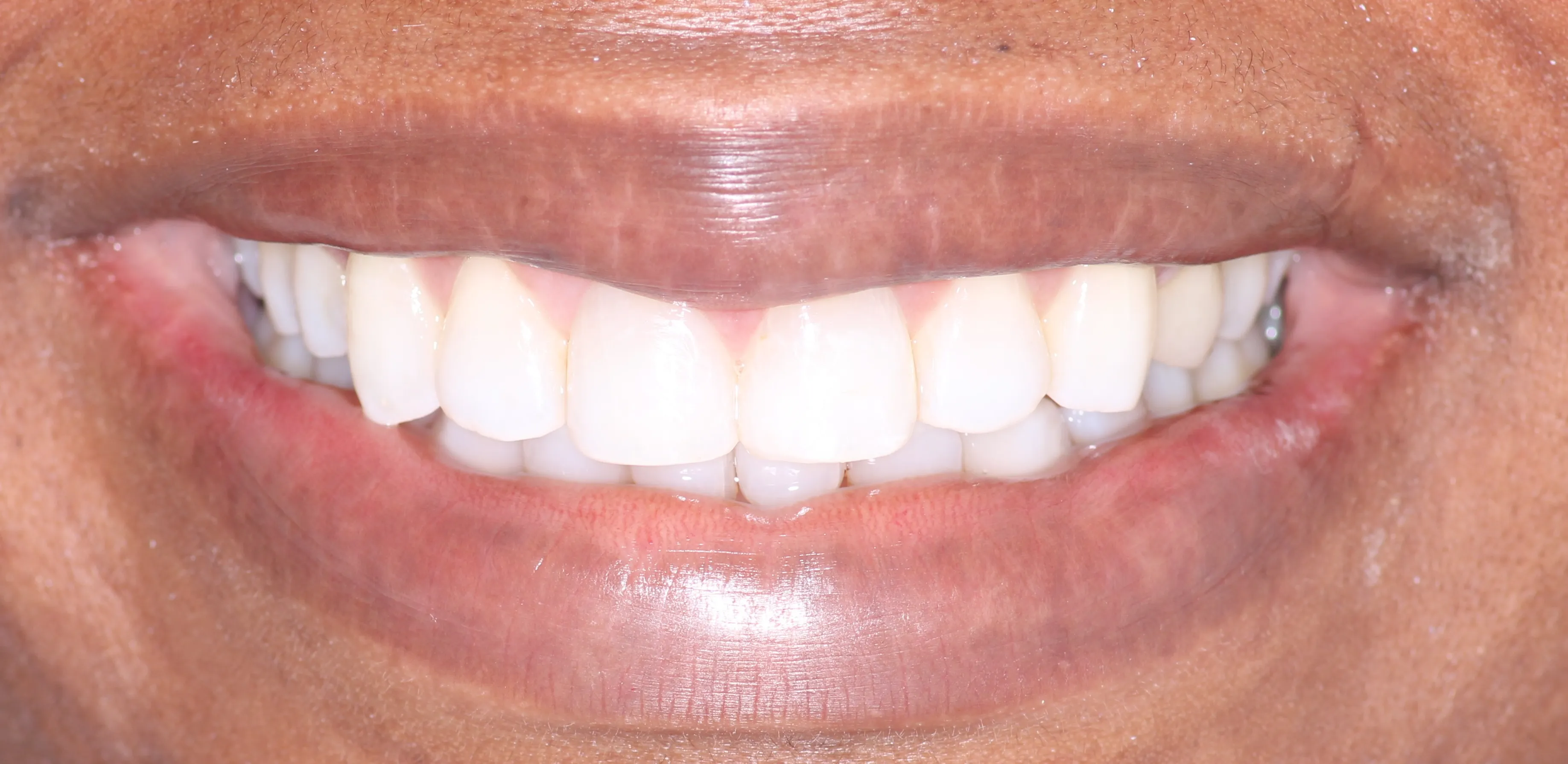 Pampered Smiles Dentistry