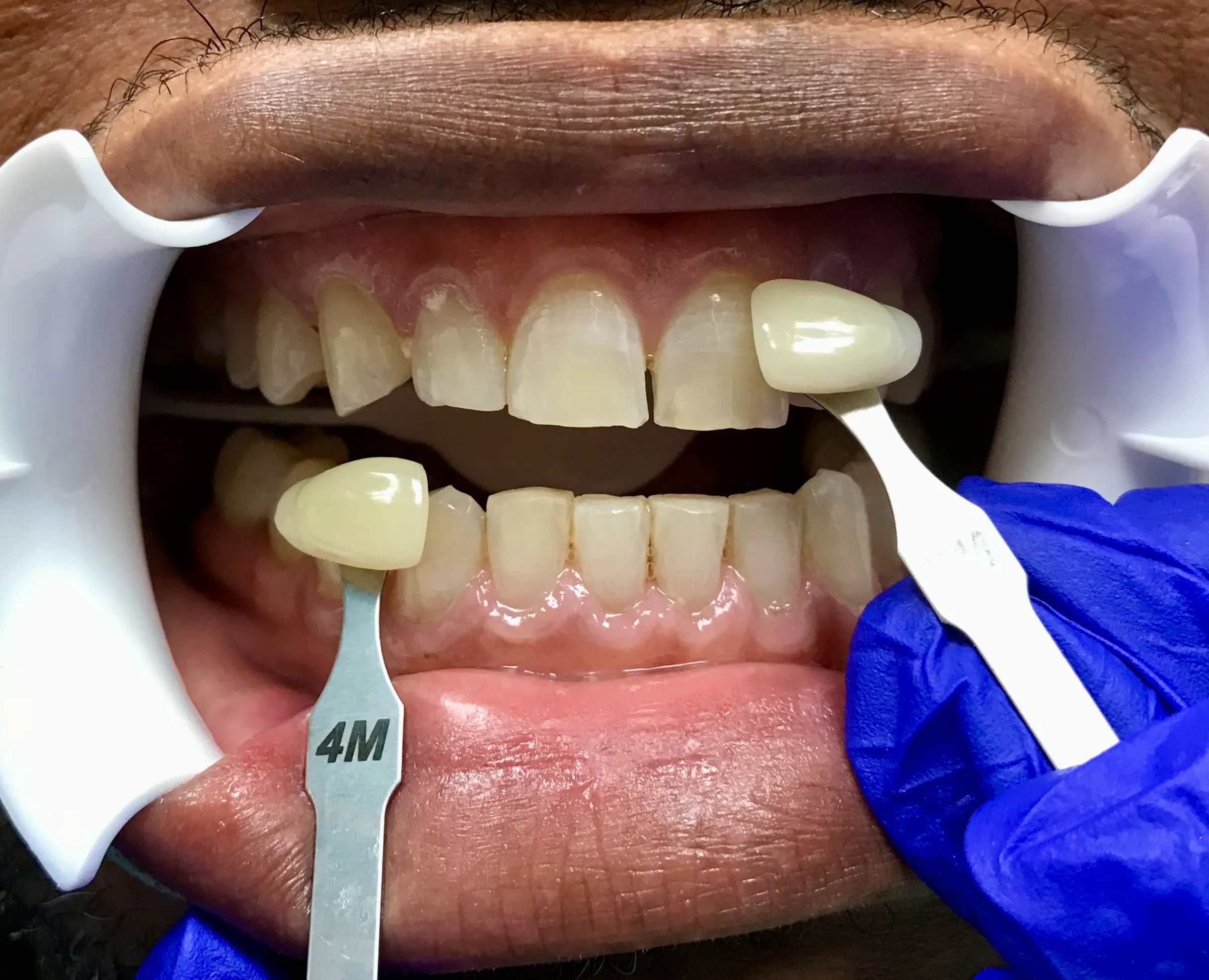 Pampered Smiles Dentistry