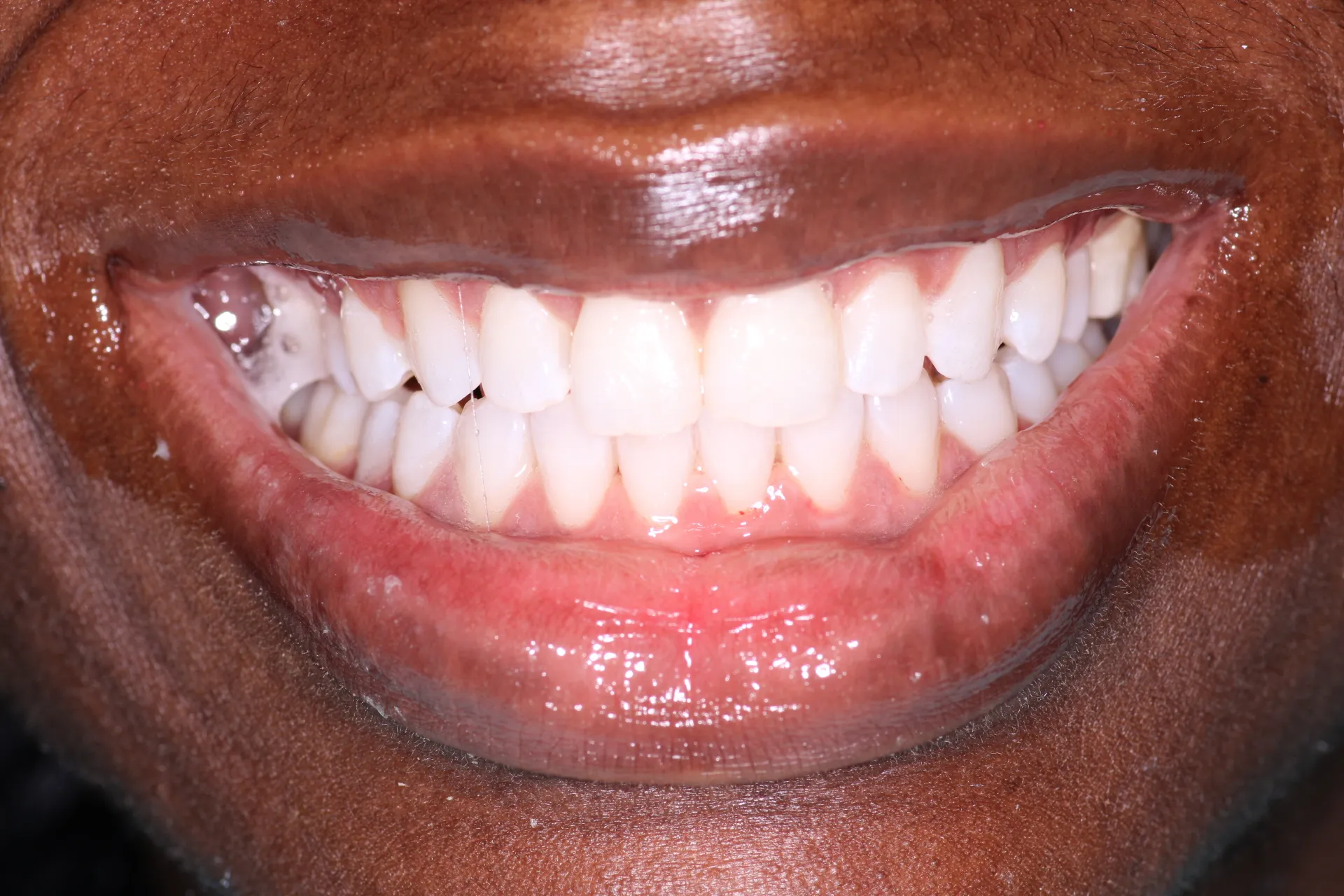 Pampered Smiles Dentistry