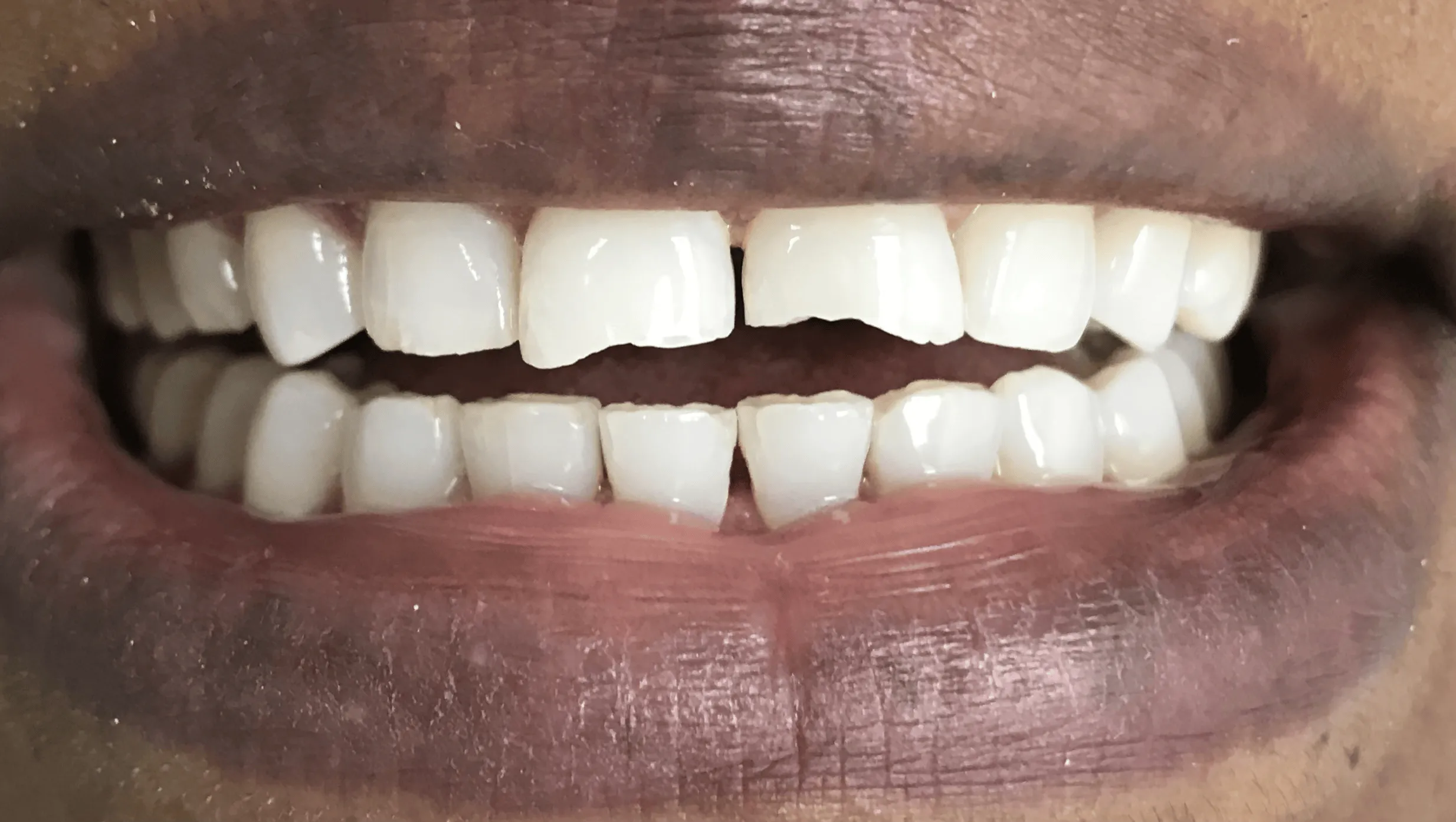 Pampered Smiles Dentistry