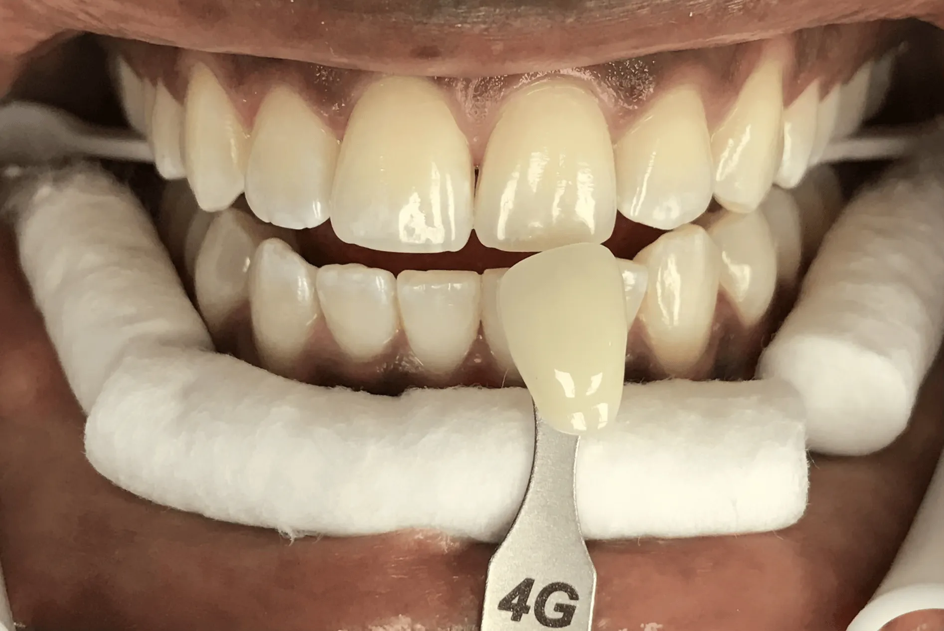 Pampered Smiles Dentistry