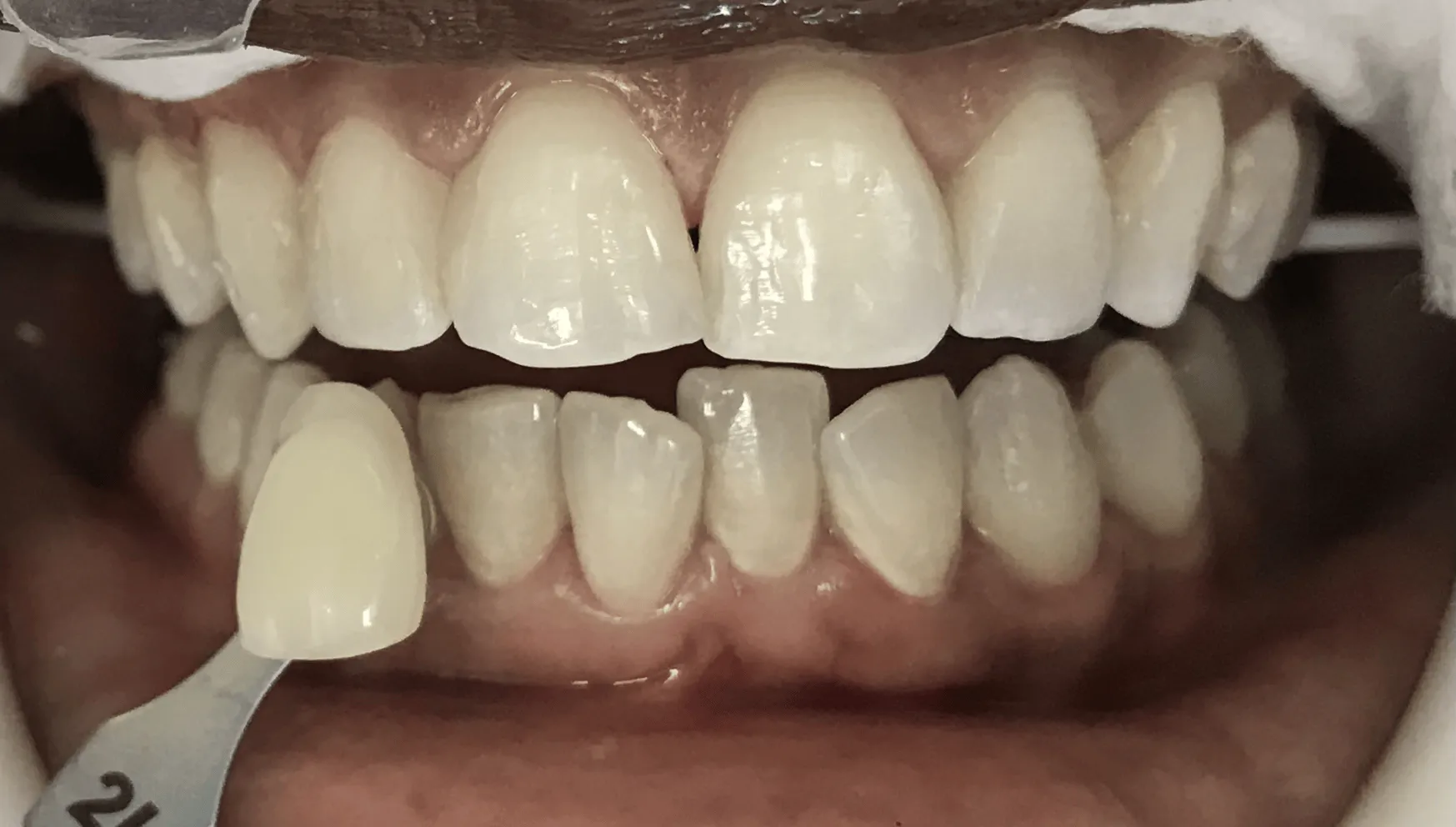 Pampered Smiles Dentistry