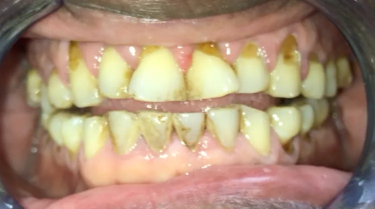 Pampered Smiles Dentistry