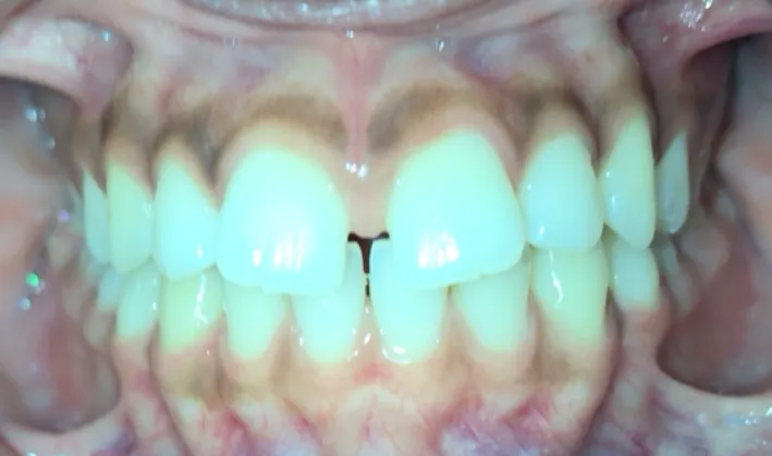 Pampered Smiles Dentistry