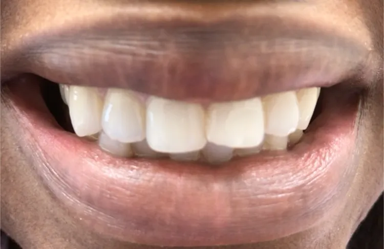 Pampered Smiles Dentistry