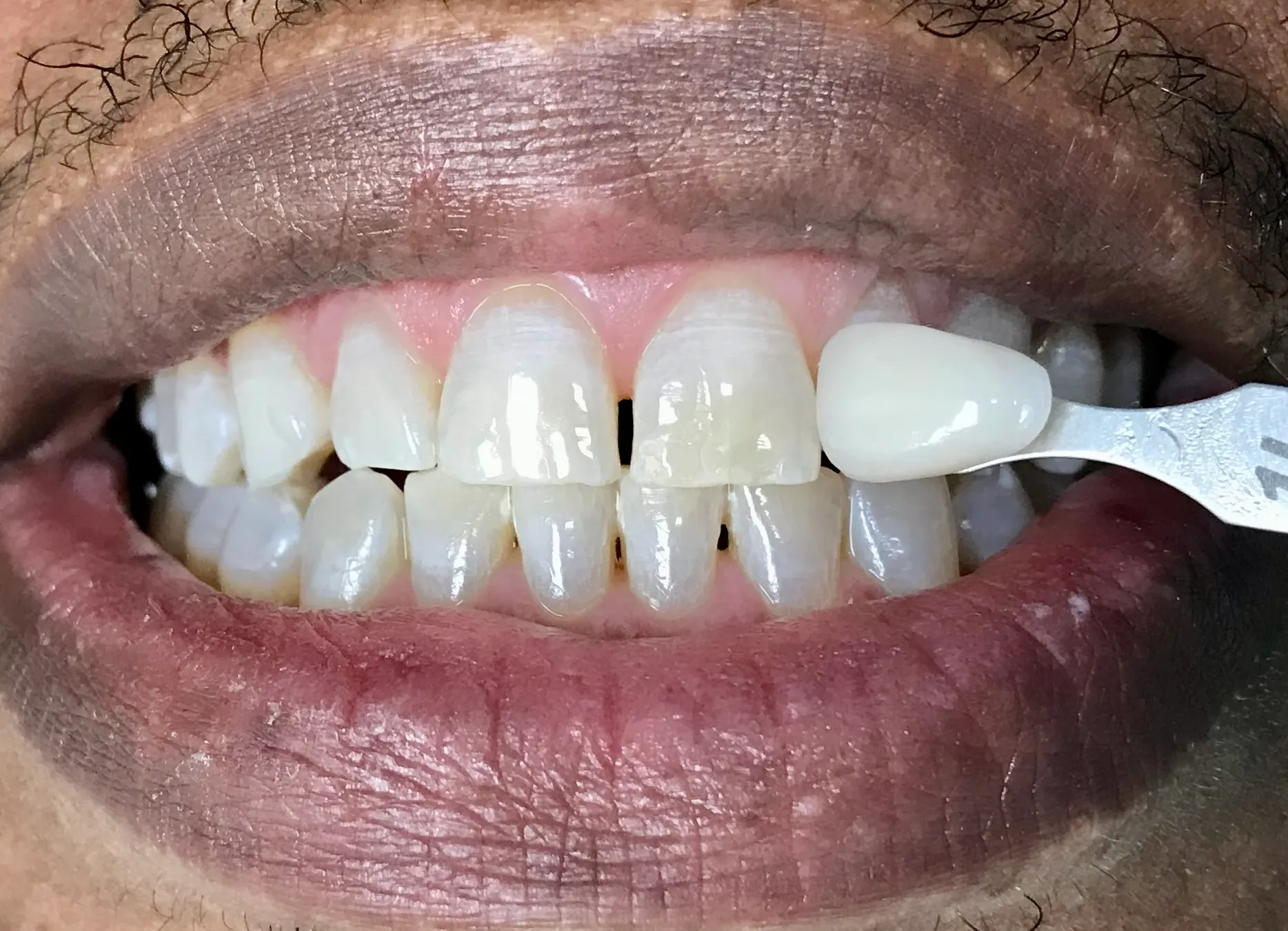 Pampered Smiles Dentistry