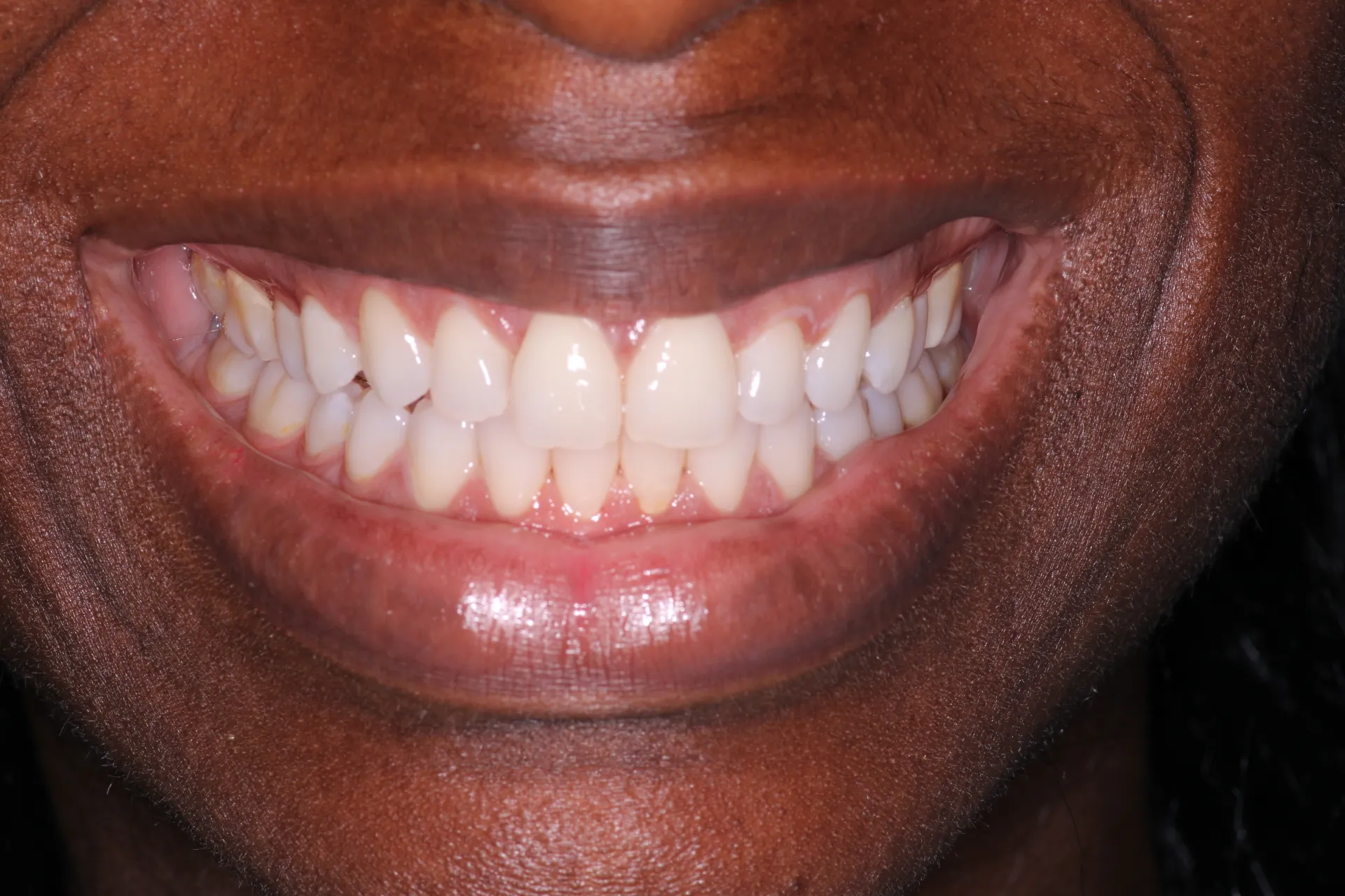 Pampered Smiles Dentistry